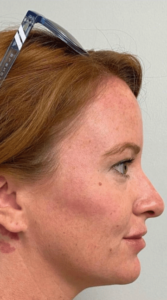 After Image: Cheeks