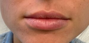 Lips