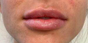 After Image: Lips