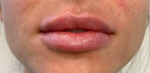 Lips