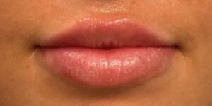 After Image: Lips