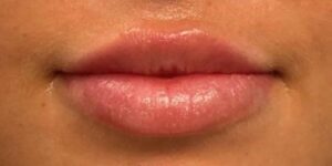 Lips