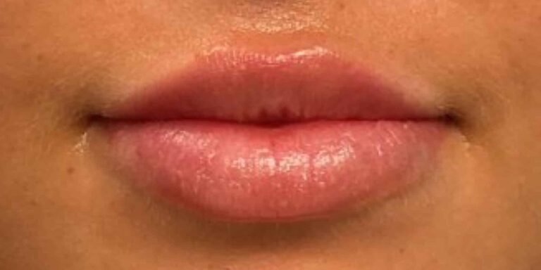 After Image: Lips - front